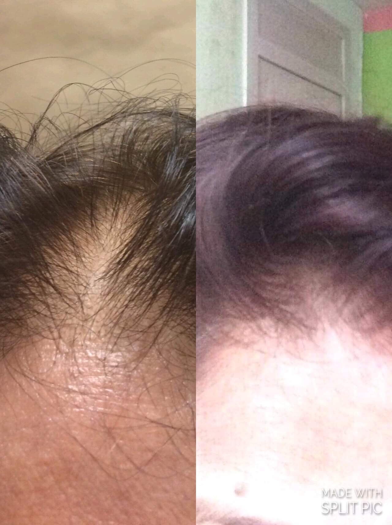 Penetrator Hair Growth Oil